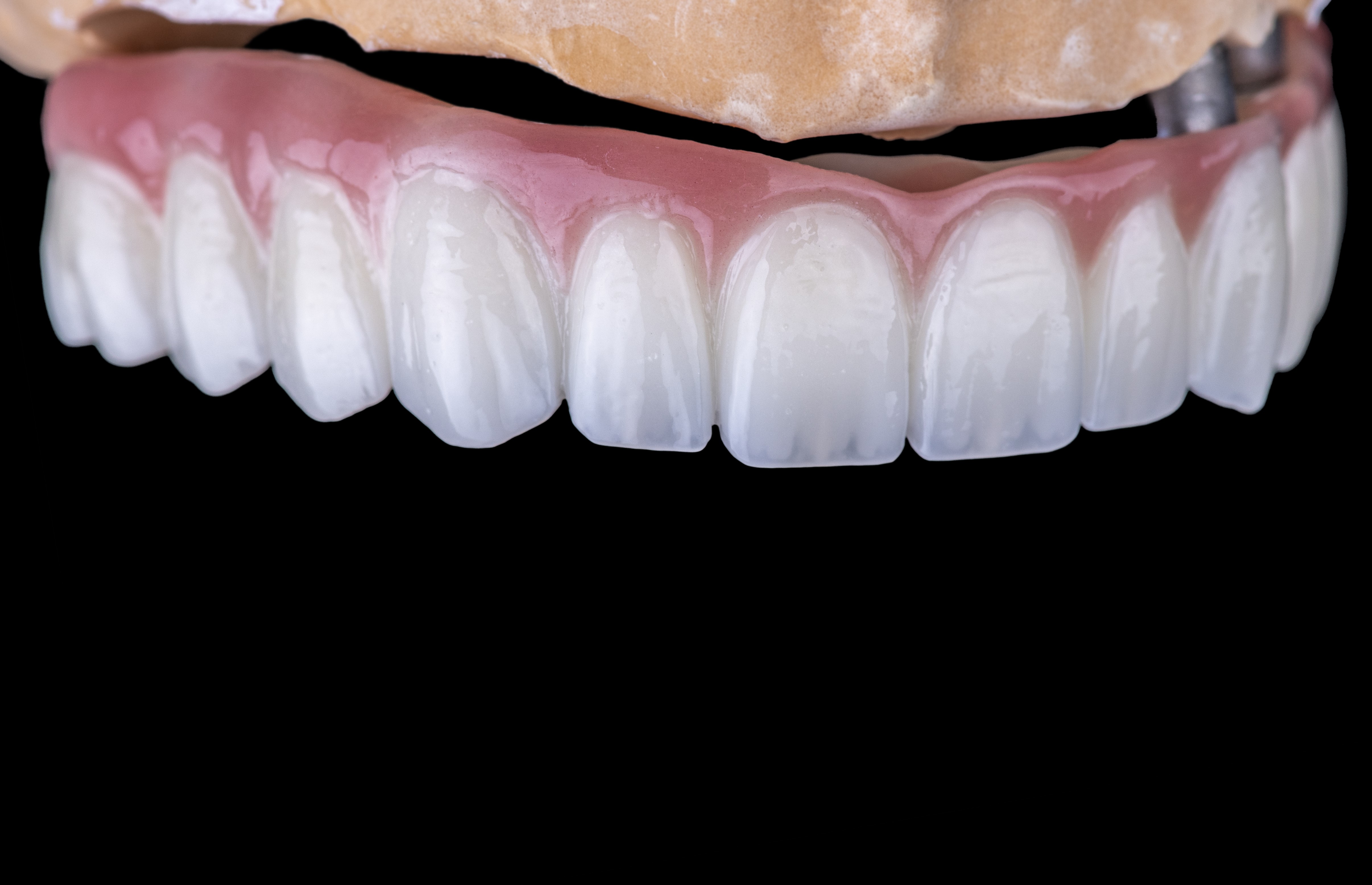 porselain denture