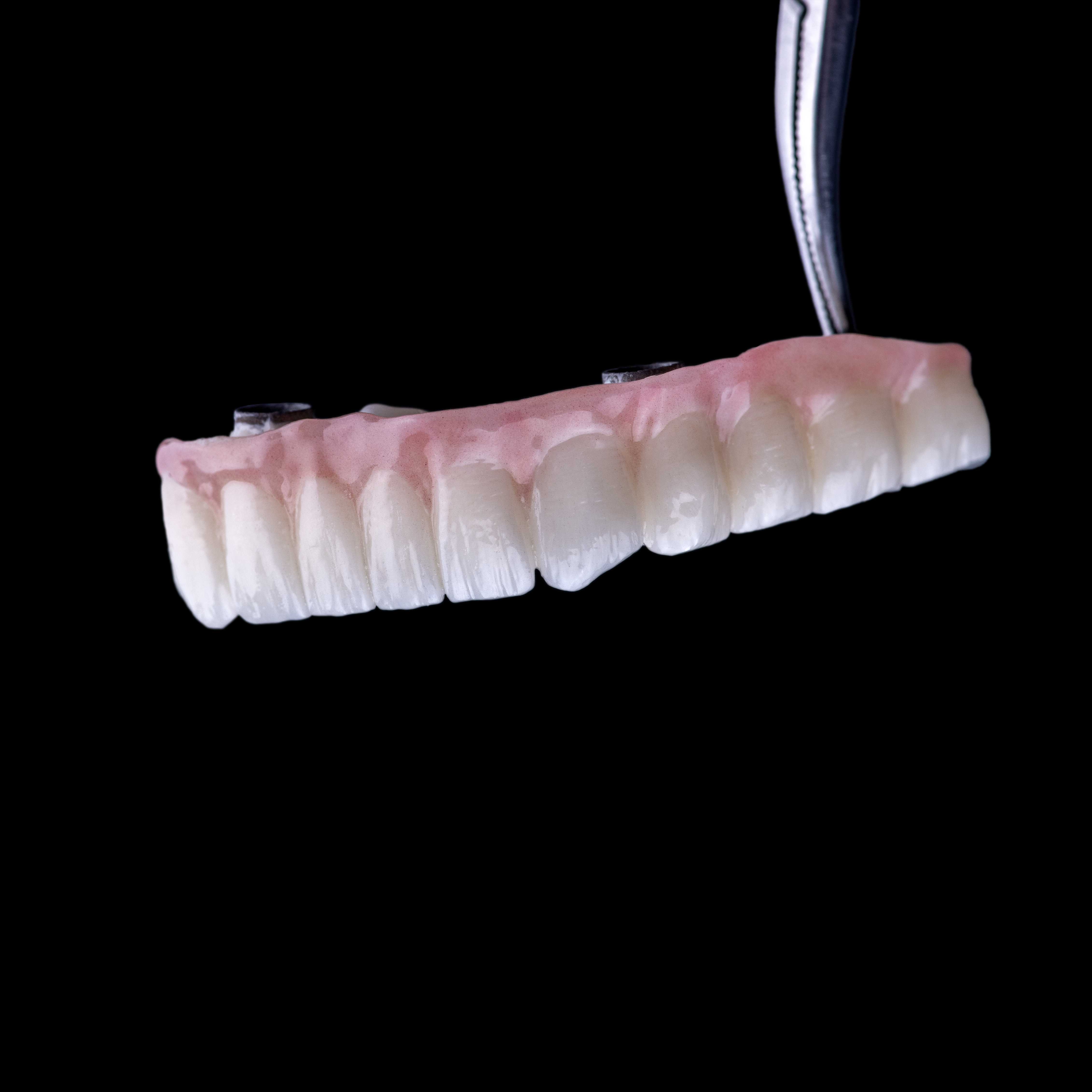 implant-supported dentures